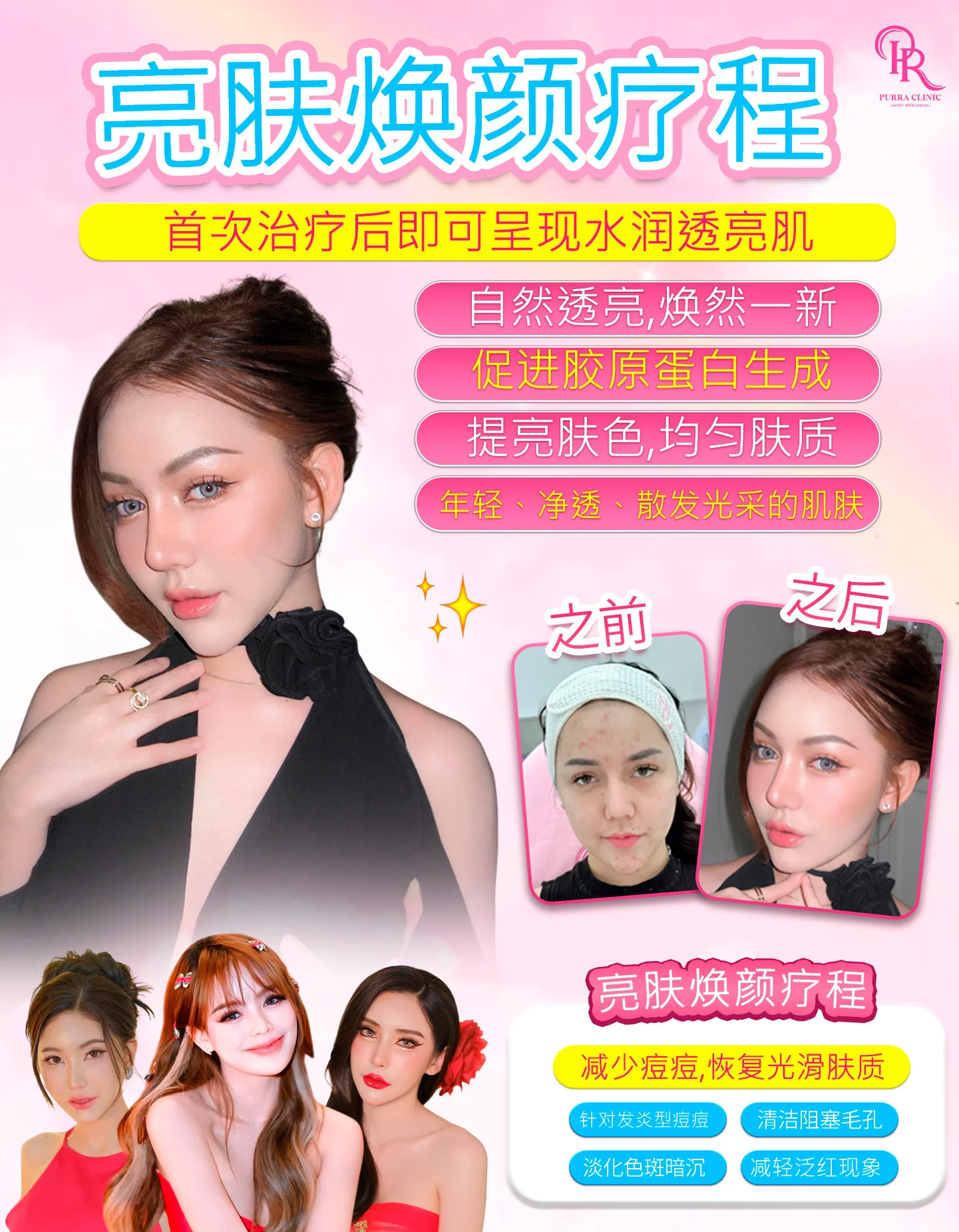 美白亮肤疗程