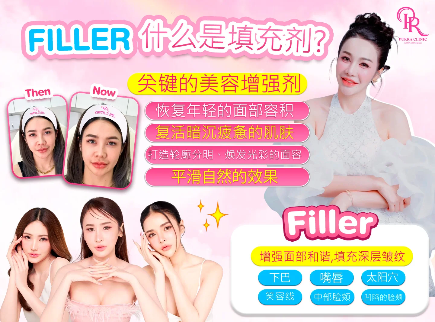 玻尿酸填充疗程