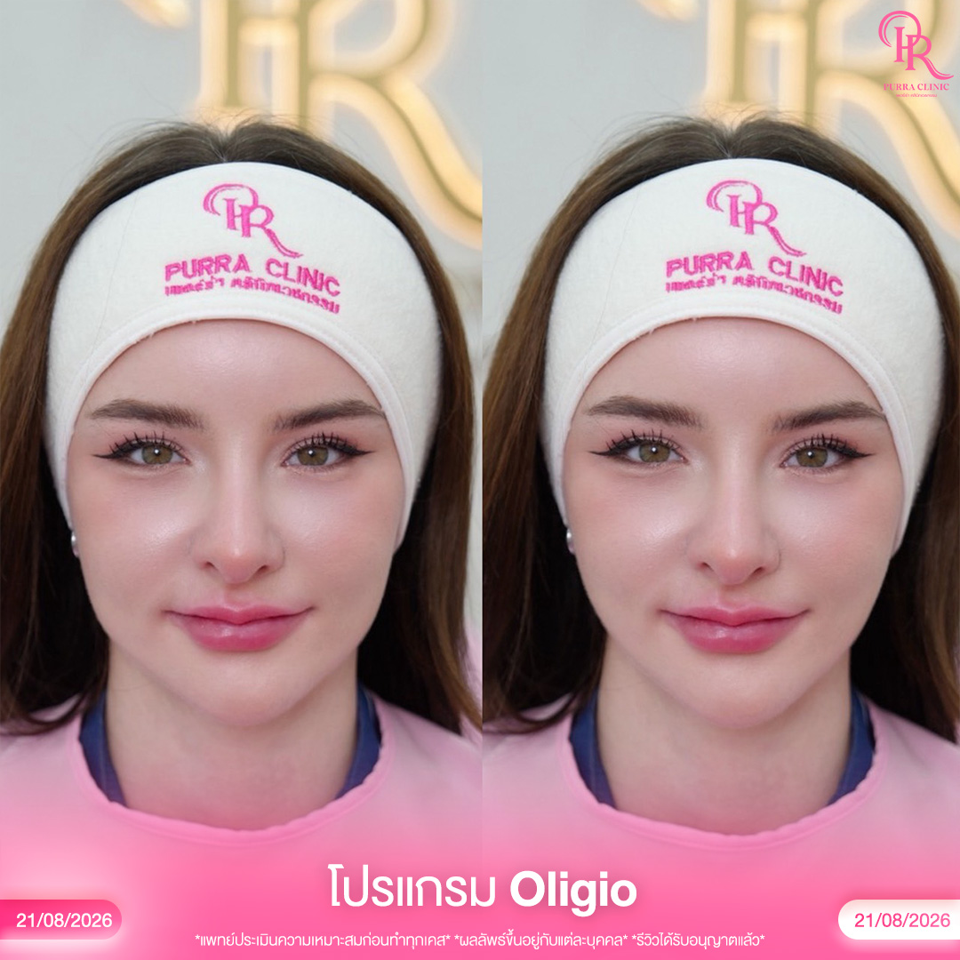 Oligio 3_0