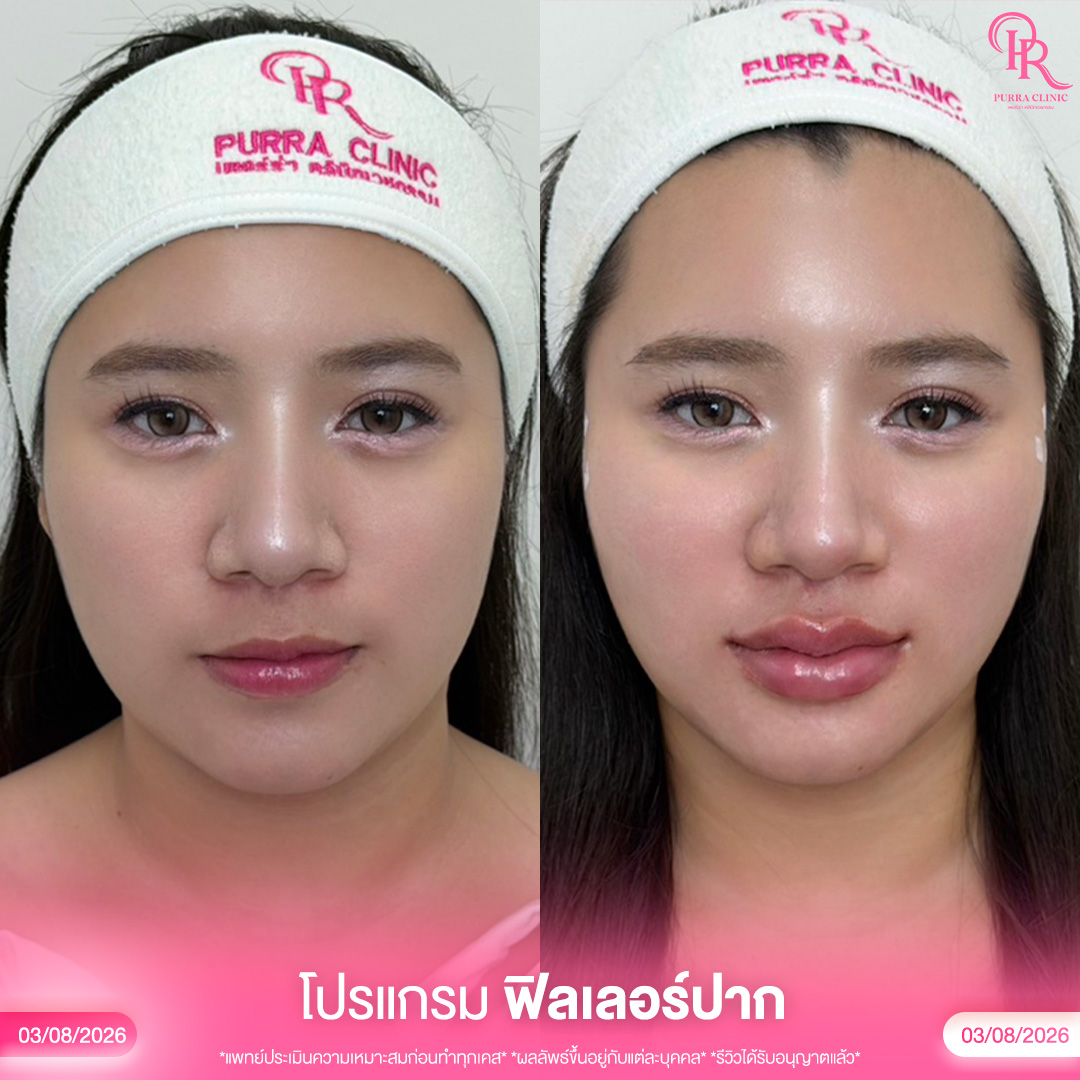 ปาก 3_0