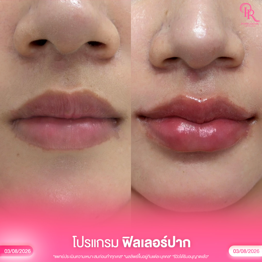ปาก 5